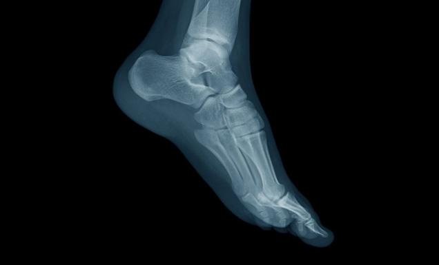 thumb-default